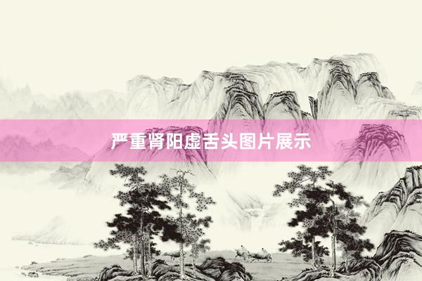 严重肾阳虚舌头图片展示
